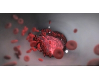 Thrombophilia: Huyết khối tĩnh mạch di truyền