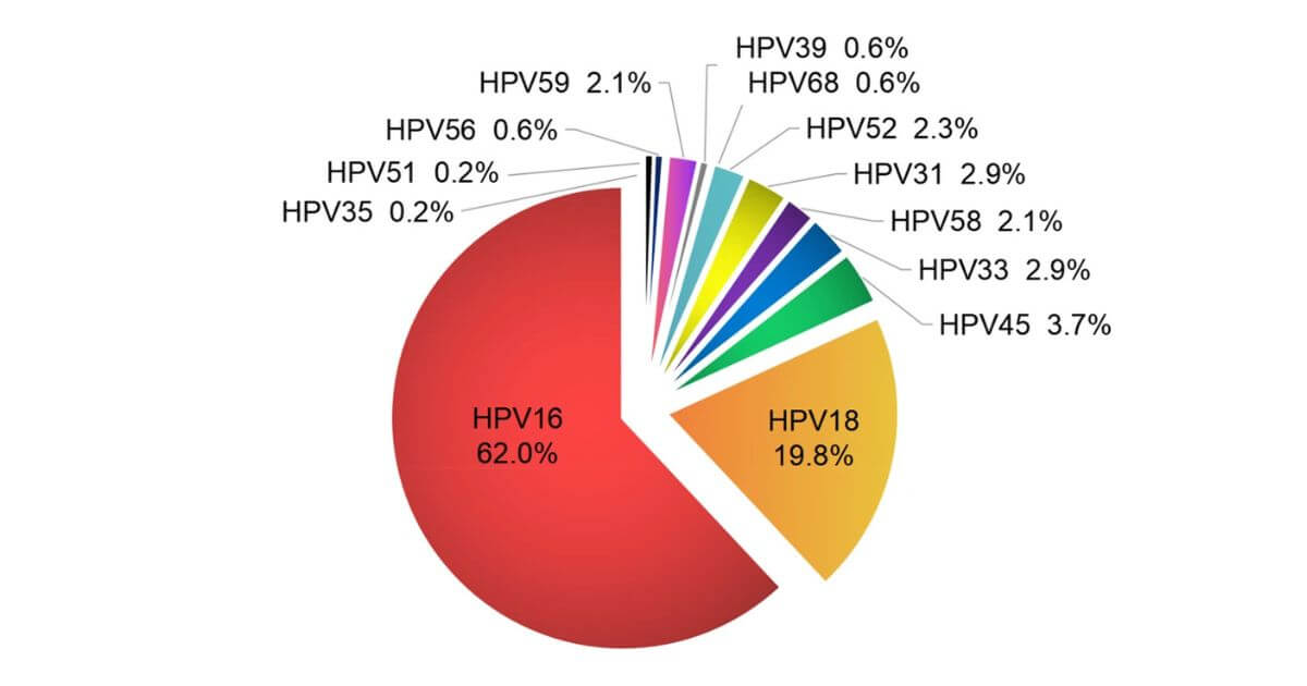 Biểu đồ tỷ lệ của các tuýp HPV phát hiện trên các mẫu ung thư cổ tử cung