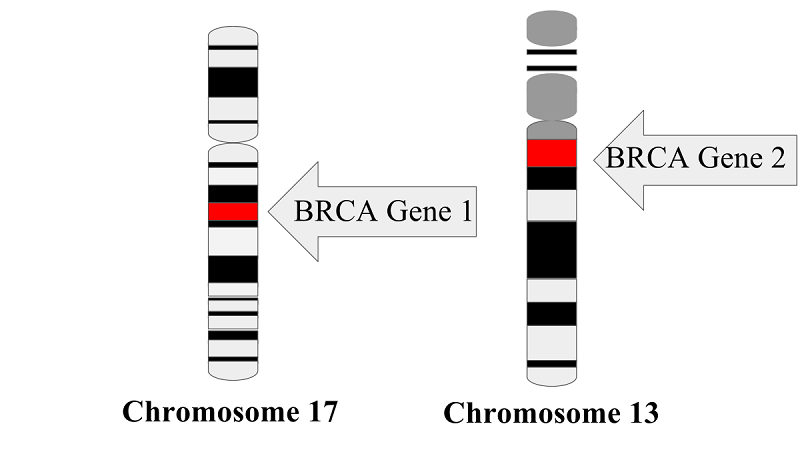 Vị trí gen BRCA1 và BRCA2 trên NST