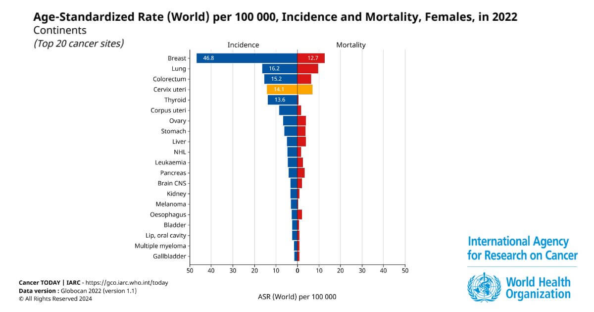 Xếp hạng 20 loại ung thư phổ biến nhất trên thế giới ở nữ giới (WHO, 2022)